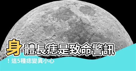 身體長痣的原因|痣是什麼？一次了解痣原因、就醫時機以及如何改善